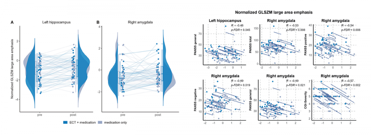 MRI texture changes in limbic gray matter after ECT in psychosis