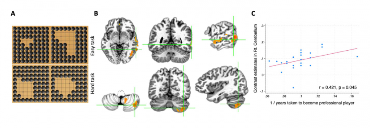 Neural basis of the approximate number system in professional Go players